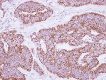 Anti-MRPL28 antibody [N2C3] used in IHC (Paraffin sections) (IHC-P). GTX115439
