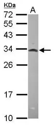 Anti-MRPL28 antibody [N2C3] used in Western Blot (WB). GTX115439