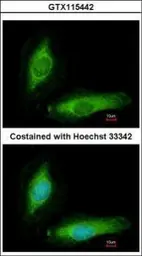 Anti-SCGN antibody [N1C2] used in Immunocytochemistry/ Immunofluorescence (ICC/IF). GTX115442