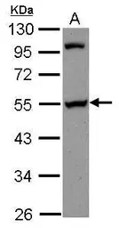 Anti-PAIP1 antibody [N3C3] used in Western Blot (WB). GTX115446