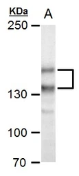 Anti-SPAG5 antibody used in Western Blot (WB). GTX115449