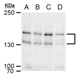 Anti-SPAG5 antibody used in Western Blot (WB). GTX115449