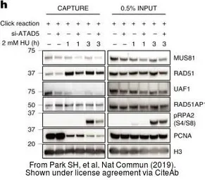 Anti-RAD51AP1 antibody [N1C1] used in Western Blot (WB). GTX115455