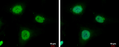 Anti-IMP3 antibody used in Immunocytochemistry/ Immunofluorescence (ICC/IF). GTX115459