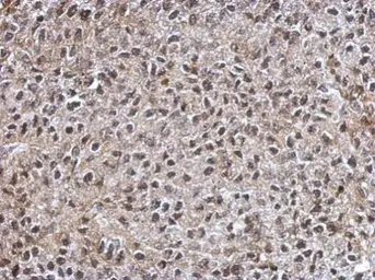 Anti-IMP3 antibody used in IHC (Paraffin sections) (IHC-P). GTX115459