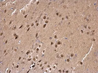 Anti-SAM68 antibody [N2C3] used in IHC (Paraffin sections) (IHC-P). GTX115462