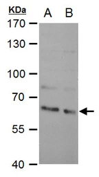 Anti-SAM68 antibody [N2C3] used in Western Blot (WB). GTX115462