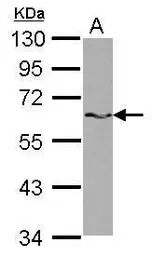 Anti-SAM68 antibody [N2C3] used in Western Blot (WB). GTX115462