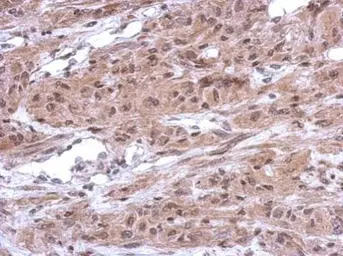 Anti-CUGBP2 antibody [N1N3] used in IHC (Paraffin sections) (IHC-P). GTX115463