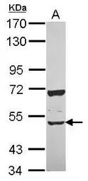 Anti-CUGBP2 antibody [N1N3] used in Western Blot (WB). GTX115463