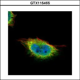 Anti-GMEB1 antibody used in Immunocytochemistry/ Immunofluorescence (ICC/IF). GTX115465