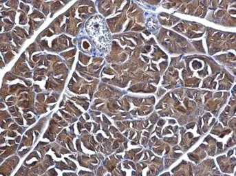 Anti-MGEA5 antibody used in IHC (Paraffin sections) (IHC-P). GTX115467