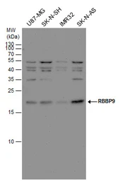 Anti-RBBP9 antibody used in Western Blot (WB). GTX115469