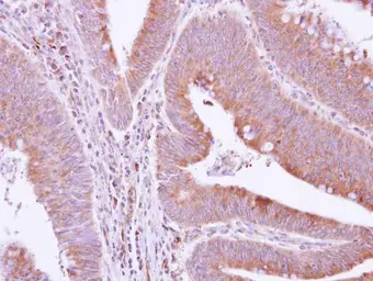 Anti-GRAP antibody [N1C3] used in IHC (Paraffin sections) (IHC-P). GTX115471