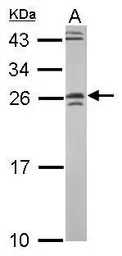 Anti-GRAP antibody [N1C3] used in Western Blot (WB). GTX115471