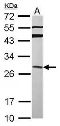 Anti-GRAP antibody [N1C3] used in Western Blot (WB). GTX115471