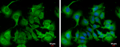 Anti-Calpain 9 antibody [N1N3] used in Immunocytochemistry/ Immunofluorescence (ICC/IF). GTX115472