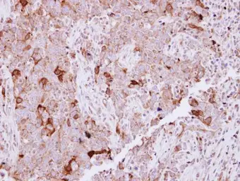 Anti-NCKAP1 antibody [N1N2], N-term used in IHC (Paraffin sections) (IHC-P). GTX115481