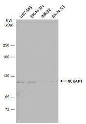 Anti-NCKAP1 antibody [N1N2], N-term used in Western Blot (WB). GTX115481