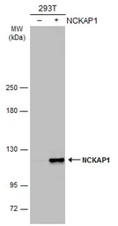 Anti-NCKAP1 antibody [N1N2], N-term used in Western Blot (WB). GTX115481