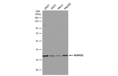 Anti-MTHFD2 antibody [N3C3] used in Western Blot (WB). GTX115482