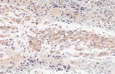 Anti-MTHFD2 antibody [N3C3] used in IHC (Paraffin sections) (IHC-P). GTX115482
