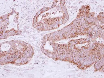 Anti-MTHFD2 antibody [N3C3] used in IHC (Paraffin sections) (IHC-P). GTX115482