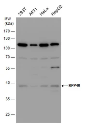 Anti-RPP40 antibody used in Western Blot (WB). GTX115483