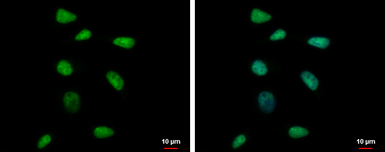 Anti-RPP40 antibody used in Immunocytochemistry/ Immunofluorescence (ICC/IF). GTX115483