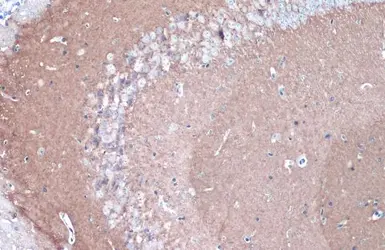 Anti-CYP46A1 antibody [N1C1] used in IHC (Paraffin sections) (IHC-P). GTX115492