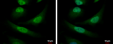 Anti-COPS8 antibody used in Immunocytochemistry/ Immunofluorescence (ICC/IF). GTX115506