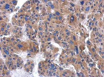Anti-AP3M2 antibody [N1C1] used in IHC (Paraffin sections) (IHC-P). GTX115508