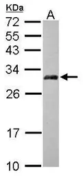 Anti-AP3M2 antibody [N1C1] used in Western Blot (WB). GTX115508