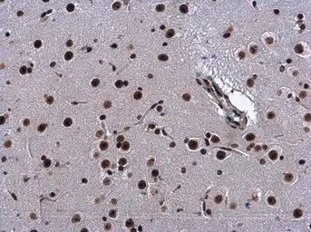 Anti-CBX1 / HP1 beta antibody used in IHC (Paraffin sections) (IHC-P). GTX115510