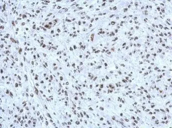Anti-CBX1 / HP1 beta antibody used in IHC (Paraffin sections) (IHC-P). GTX115510
