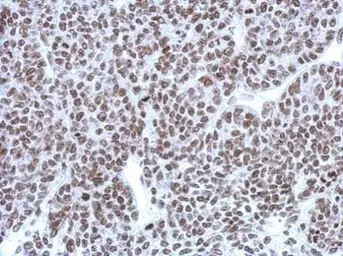 Anti-CBX1 / HP1 beta antibody used in IHC (Paraffin sections) (IHC-P). GTX115510