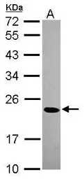 Anti-CBX1 / HP1 beta antibody used in Western Blot (WB). GTX115510