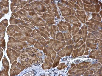 Anti-PDIR antibody [N1N3] used in IHC (Paraffin sections) (IHC-P). GTX115511