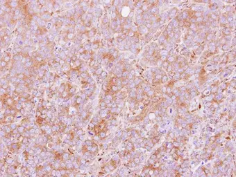 Anti-PDIR antibody [N1N3] used in IHC (Paraffin sections) (IHC-P). GTX115511