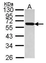 Anti-PDIR antibody [N1N3] used in Western Blot (WB). GTX115511