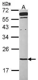 Anti-TMED2 antibody [N1C3-2] used in Western Blot (WB). GTX115514