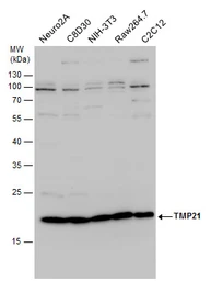 Anti-TMP21 antibody used in Western Blot (WB). GTX115517