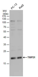 Anti-TMP21 antibody used in Western Blot (WB). GTX115517