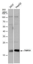 Anti-TMP21 antibody used in Western Blot (WB). GTX115517