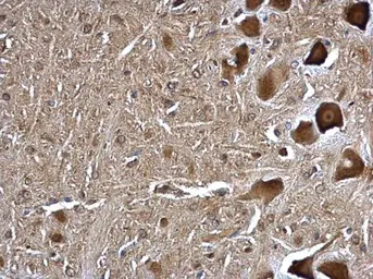 Anti-TMP21 antibody used in IHC (Paraffin sections) (IHC-P). GTX115517