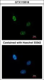 Anti-CLP1 antibody [N3C3] used in Immunocytochemistry/ Immunofluorescence (ICC/IF). GTX115518