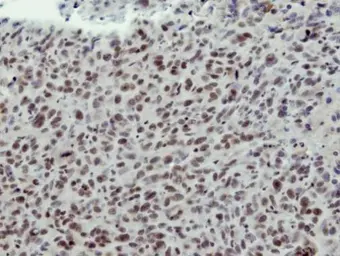 Anti-CLP1 antibody [N3C3] used in IHC (Paraffin sections) (IHC-P). GTX115518