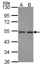 Anti-CLP1 antibody [N3C3] used in Western Blot (WB). GTX115518