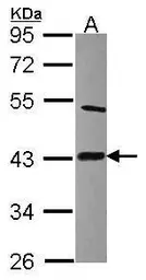 Anti-Lipoic acid synthetase antibody [N1C2] used in Western Blot (WB). GTX115528