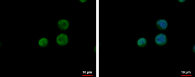 Anti-CPSF6 antibody used in Immunocytochemistry/ Immunofluorescence (ICC/IF). GTX115537